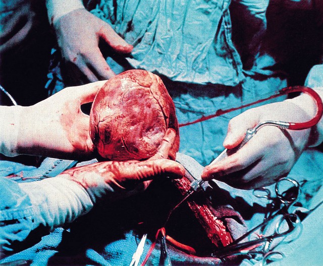 | © Slovenija-transplant