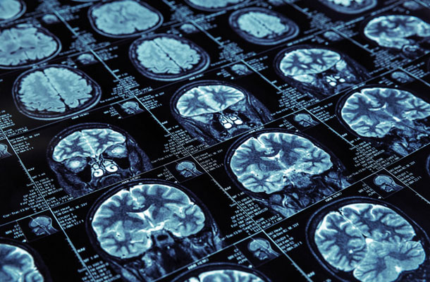 Se info doba že zrcali na strukturi človeških možganov? 