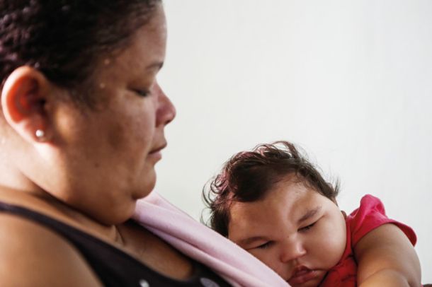 Enoletna Maria Eduarda, ki se je rodila z mikrocefalijo in ki se ji je mama ob rojstvu odrekla, zdravniki pa so ji napovedal največ tri mesece življenja.