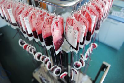 Priprava komponent krvi s ﬁltracijo - odstranjevanje levkocitov iz zbrane krvi na Zavodu za transfuzijsko medicino. 