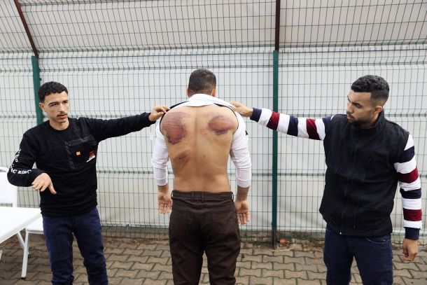 Maroški migranti Abedelkarim Roumane, Omar Halimi in Mehdi Abboubi kažejo posledice prisilne vrnitve s strani grških varnostnih organov na grško-turški meji, november 2023, Odrin, Turčija. 
