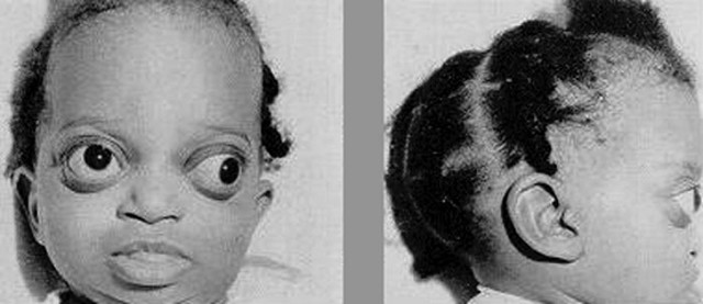 Mlada Oprah