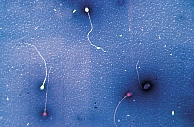 Test vitalnosti: seme obarvajo s posebnim barvilom eozin-nigrozin. Ker membrana živih spermijev barvila ne prepušča, ostanejo beli, mrtvi spermiji pa se obarvajo roza.