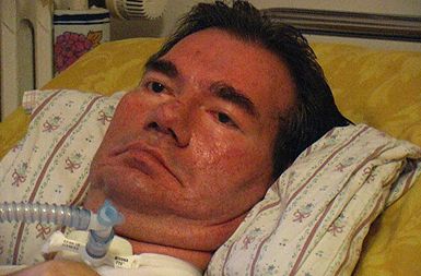 Piergiorgia Welbyja, ki so ga izklopili iz respiratorja, cerkev ni dovolila cerkveno pokopati