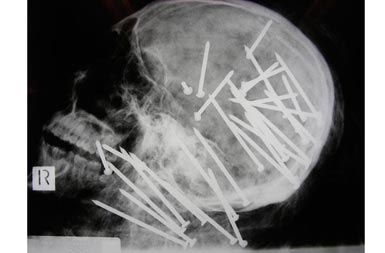/media/www/slike.old/novice/nailsskull_1390739i.jpg