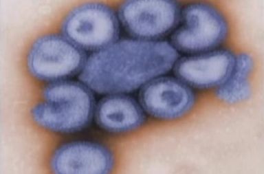 /media/www/slike.old/novice/virus_copy3.jpg