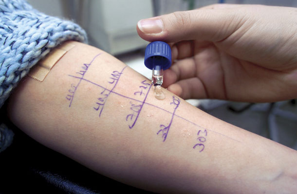 Kožni testi z majhnimi količinami različnih, že vnaprej pripravljenih alergenov