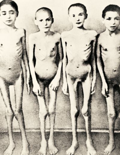 Kastracija dvojčkov pod vodstvom doktorja Mengeleja v Auschwitzu.