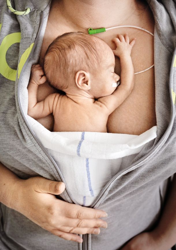 Kengurujčkanje pri mami (stik koža na kožo). Sedem tednov stara deklica se je rodila v 27. tednu nosečnosti in ob rojstvu tehtala 620 gramov