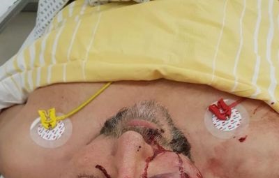 Fotografija Franka Magnitza na bolniški postelji, ki jo je na svoji strani na Facebooku objavila skrajno desna stranka AfD (Alternativa za Nemčijo) 