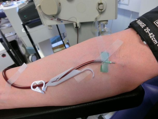 Darovanje krvne plazme