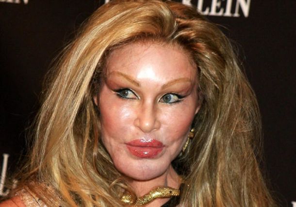 Jocelyn Wildenstein, ena od medijsko bolj izpostavljenih žrtev plastičnih operacij