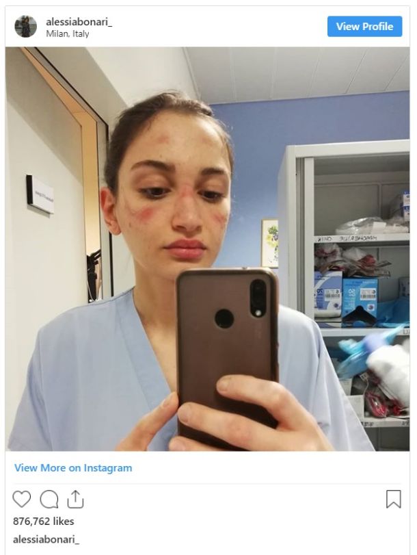 Na fotografiji je Alessia Bonari, mlada medicinska sestra iz Milana po nekaj urah nošenja zaščitne opreme ... 