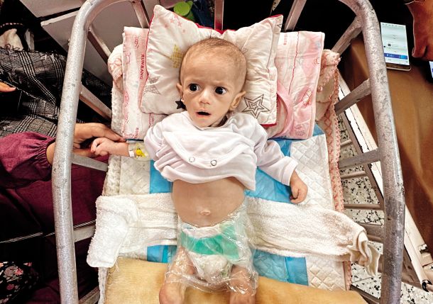 Šestmesečna Sivar Ašur. Pri njeni starosti naj bi imela okoli šest kilogramov, ona ima komaj dva. Te vojne najbrž ne bo preživela. 