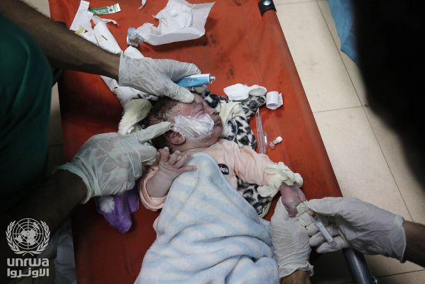 Palestinski otrok ranjen med izraelskim napadom na Gazo