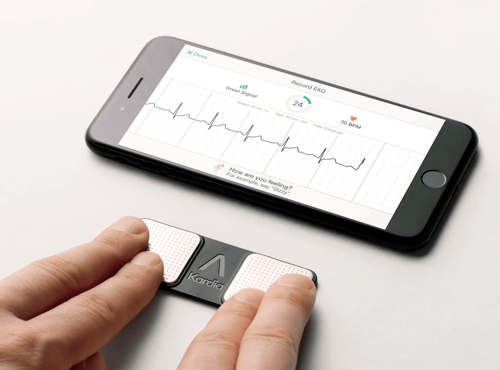 EKG pri roki