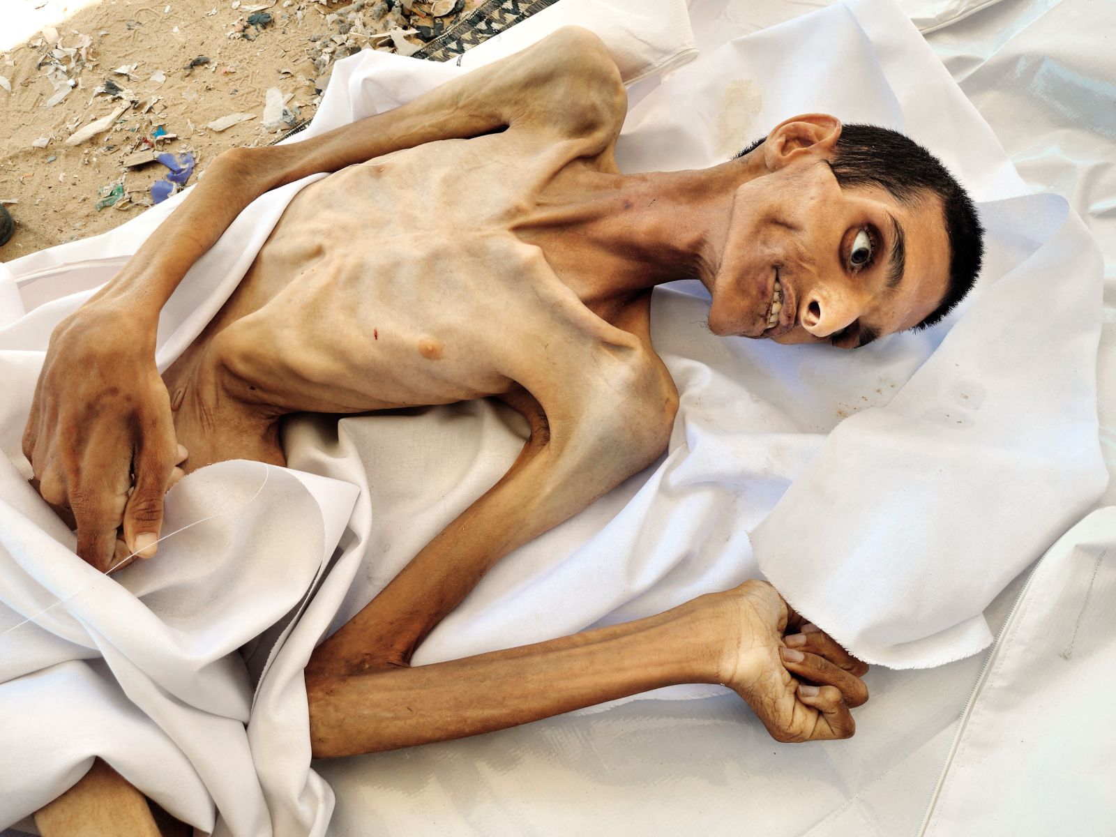 Žrtev lakote v taborišču Han Junis