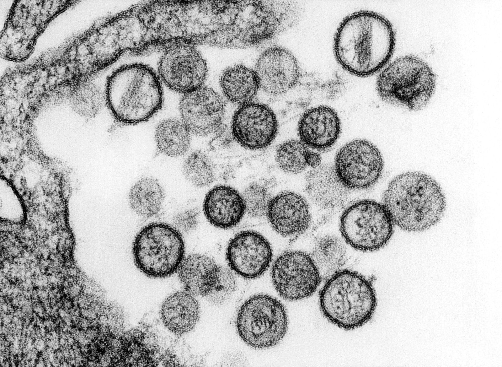Hantavirus / &nbsp;»Ni razloga za paniko ali omejitve potovanj«